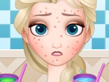 flash игра Squeeze Elsa pimples