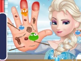 Elsa. Hand doctor